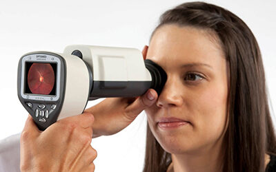 Fundus kamera Smartscope PRO